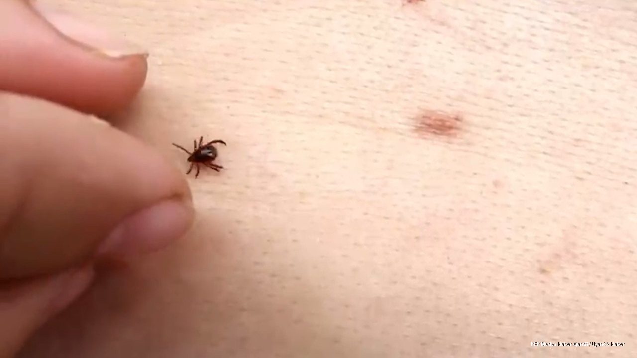 Kenelere Karşı Yaz Uyarısı: Uzmandan Tedbir Çağrısı
